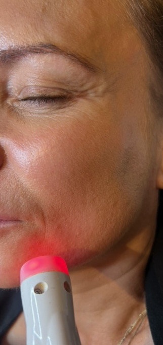 CELLUMA - LED LOW LIGHT THERAPY