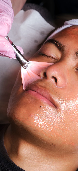 SKIN PEELS